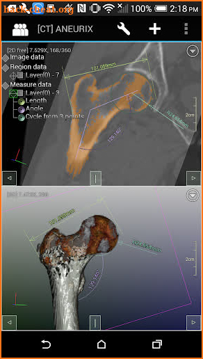 DroidRender - 3D DICOM viewer screenshot