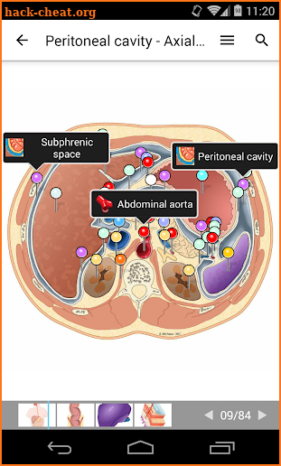 e-Anatomy screenshot