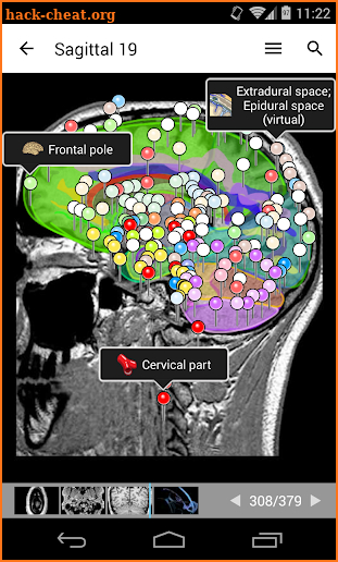 e-Anatomy screenshot