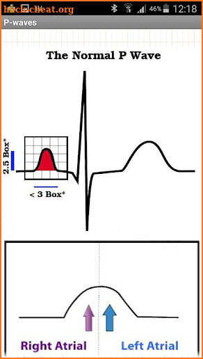 Easy ECG screenshot