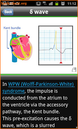 easy ECG training screenshot