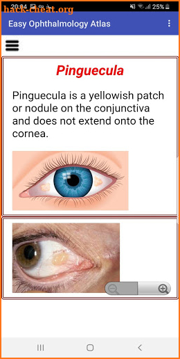 Easy Ophthalmology Atlas screenshot