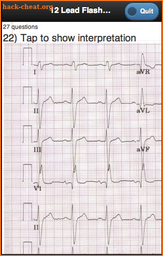 ECG Academy screenshot