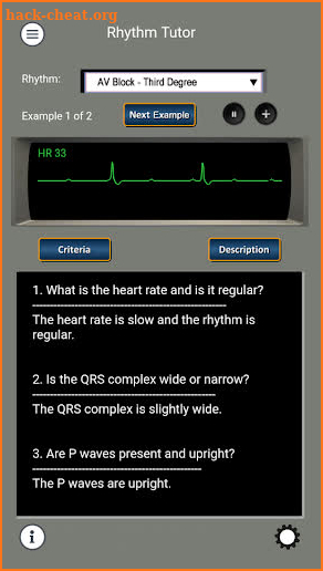 ECG and ACLS Tutor screenshot