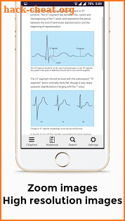 ECG Basics - Full screenshot