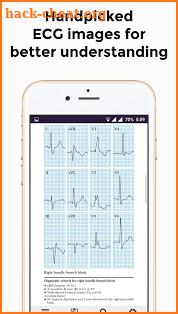 ECG Basics - Learning and interpretation made easy screenshot