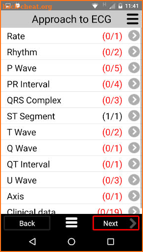 ECG CALC screenshot