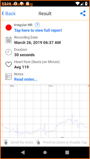 ECG Check screenshot