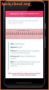 ECG FlashCards screenshot