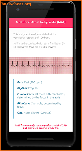 ECG FlashCards - Free screenshot