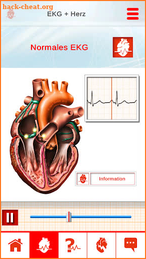 ECG in Motion – The innovative ECG education-tool screenshot