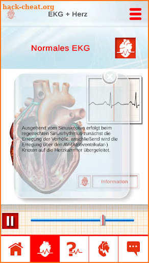 ECG in Motion – The innovative ECG education-tool screenshot