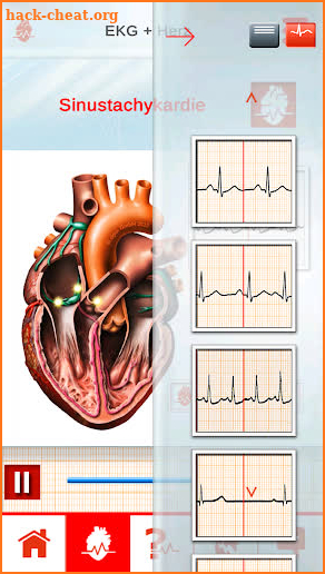 ECG in Motion – The innovative ECG education-tool screenshot