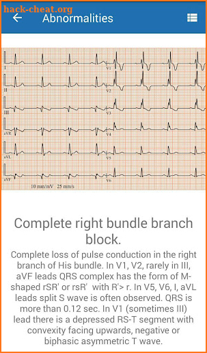 ECG  Interpretation and Tests. screenshot