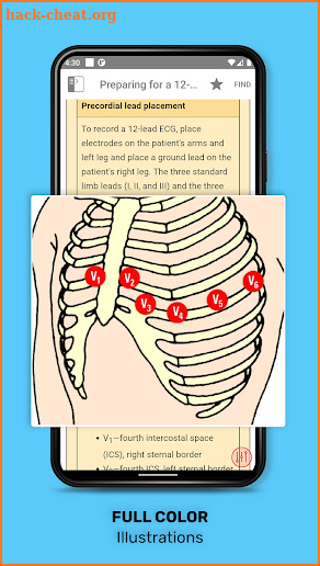 ECG Interpretation: Pkt Guide screenshot