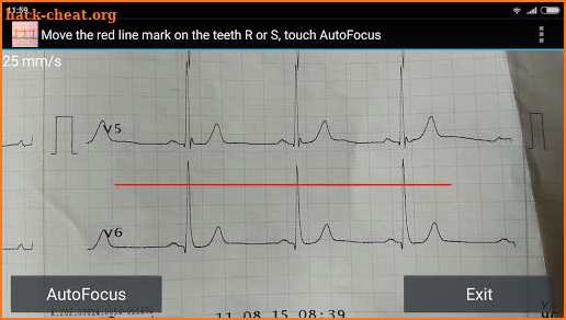 ECG Reader screenshot