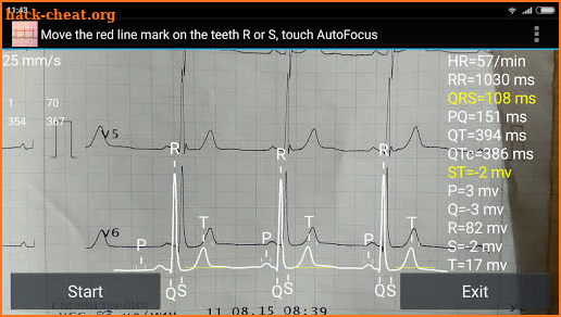 ECG Reader screenshot