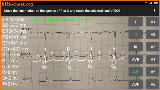 ECG Reader 2 screenshot