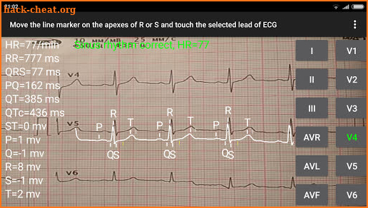 ECG Reader 2 screenshot