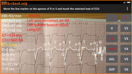 ECG Reader 2 screenshot