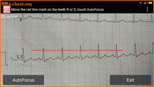 ECG Reader screenshot