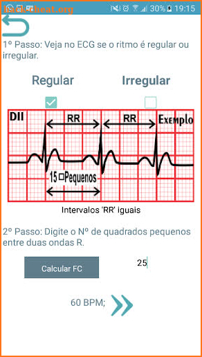 ECG Report screenshot