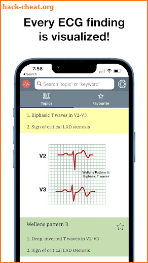 ECG Stat screenshot