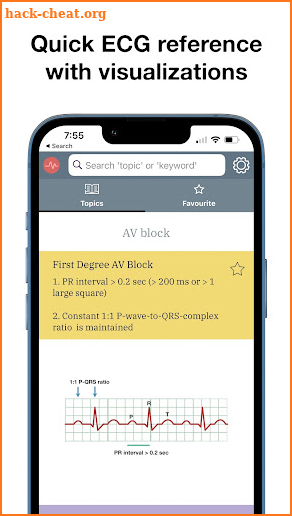 ECG Stat screenshot