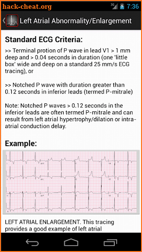 ECGsource screenshot