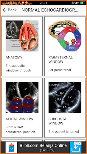 ECHOCARDIOGRAPHY GUIDE screenshot