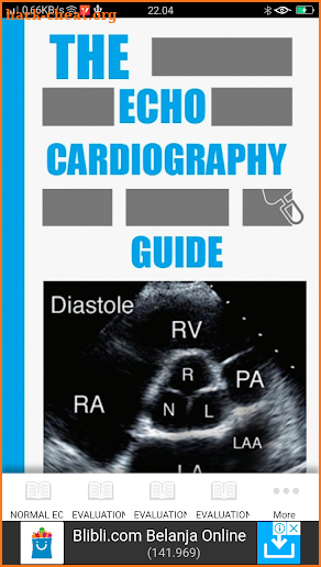 ECHOCARDIOGRAPHY GUIDE screenshot