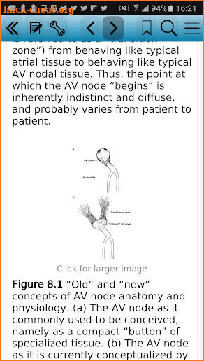 Electrophysiologic Testing, 5 screenshot