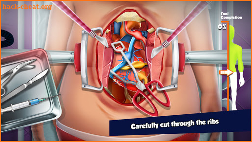 Emergency Open Heart Surgery : Offline Doctor Game screenshot