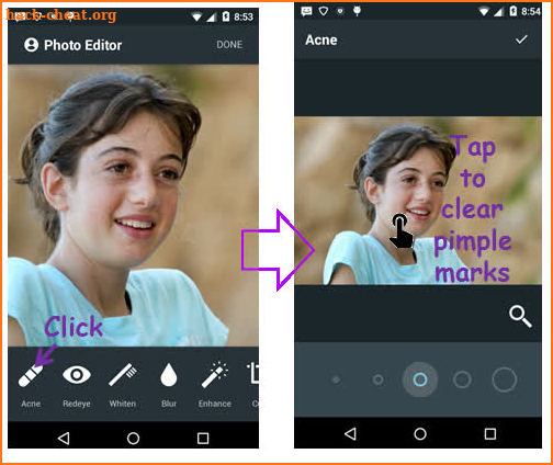 Face Acne Remover Photo Editor App screenshot