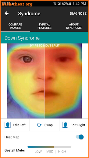 Face2Gene screenshot