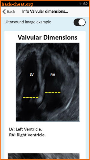 Fetal calculator PRO screenshot