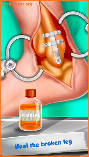 Foot Surgery Doctor Care:Free Offline Doctor Games screenshot