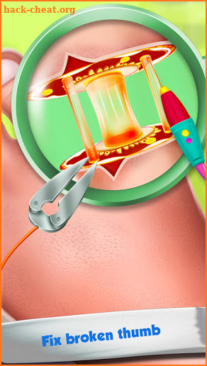 Foot Surgery Doctor Care:Free Offline Doctor Games screenshot