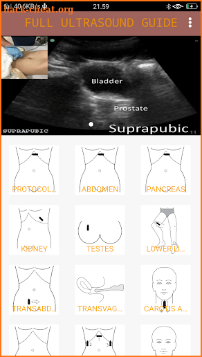 FULL ULTRASOUND GUIDE screenshot