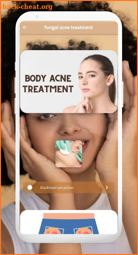 fungal acne treatment screenshot