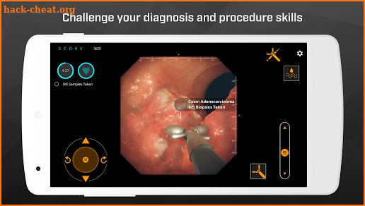 Gastro Ex – Scope. Biopsy. APC. Train. screenshot