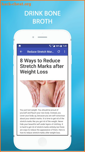 Get Rid of Body Stretch Marks screenshot