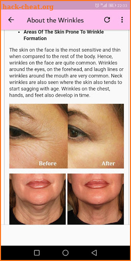 Get Rid Of Wrinkles Naturally - Tips and Remedies screenshot