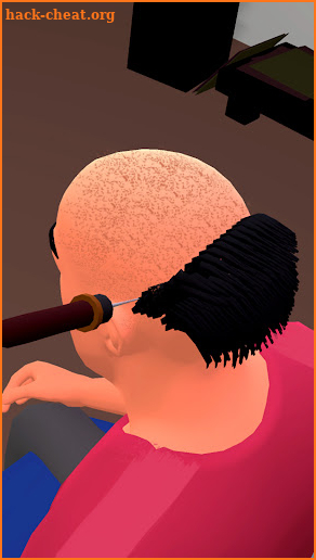 Hair Transplant 3D Game screenshot