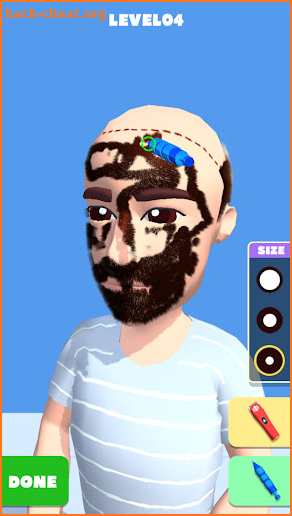 Hair Transplant Simulation screenshot