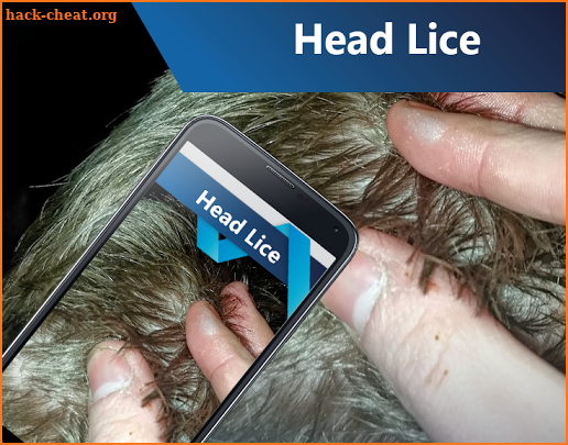 Head Lice screenshot