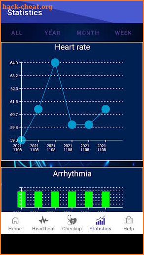 Heart dysrhythmias screenshot