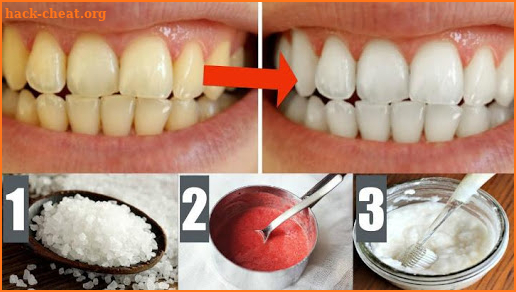 Home Remedies for Yellow Teeth screenshot