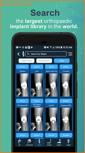 Implant Identifier screenshot