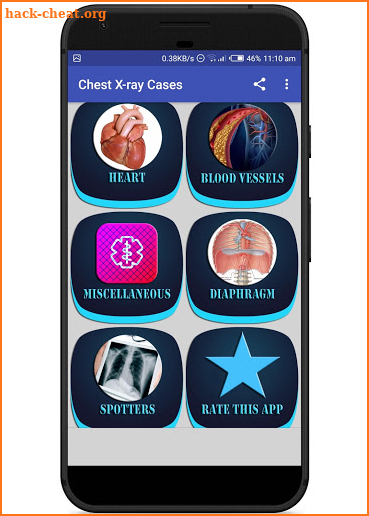 Interpret Chest X-Ray With 100 Cases screenshot